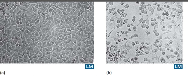<strong>What type of organism has caused the abnormal changes in these cells in Figure (b)? The cells in Figure (a)are normal.  </strong> A)Fungus B)Protozoa C)Virus D)Bacteria <div style=padding-top: 35px> 