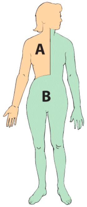 <strong>Region A in this image drains lymph into the: </strong> A)right carotid artery B)right subclavian vein C)superior vena cava D)inferior vena cava