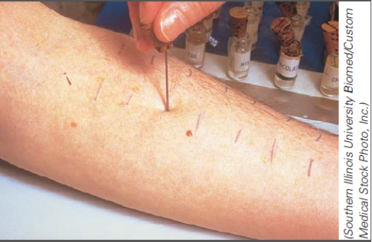 <strong>What type of testing is demonstrated in this figure? </strong> A)Immunodeficiency B)Allergy C)Transplant D)Serological