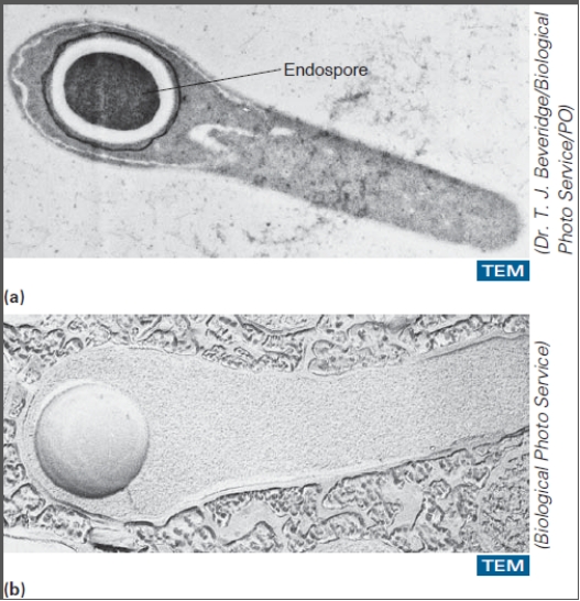 <strong>This organism can exist in the spore form and cause tetanus. </strong> A)Mycobacterium leprae B)Clostridium tetani C)Clostridium difficile D)Clostridium botulinum