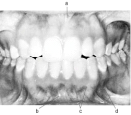 In the following illustration, structure b is the