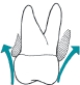 <strong>Which illustration in depicts an overcontoured restoration?</strong> A)   B)   C)   <div style=padding-top: 35px> 