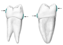 <strong>What are the arrows pointing to in the illustration below?  </strong> A) Contact areas B) Height of curvature C) Buccal contour D) Excess curvature E) None of the above <div style=padding-top: 35px> 
