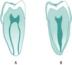 <strong>The figure below shows a mesial view (A) and a distal view (B) of a linguobuccal section. Identify the tooth. </strong> A) Mandibular first premolar B) Mandibular second premolar C) Mandibular first molar D) Mandibular second molar