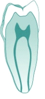 <strong>Which of the following best describes the root canal opening(s) in the figure below? </strong> A) Accessory root canals B) One main and one accessory root canal C) Two apical root canals