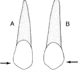 <strong>In the illustration below, Figure B is a  </strong> A) Maxillary central incisor B) Maxillary lateral incisor C) Mandibular canine D) Maxillary canine <div style=padding-top: 35px> 
