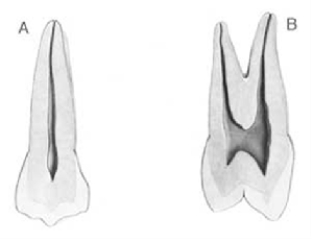 <strong>Figure A below is which tooth? </strong> A) Maxillary right second premolar B) Maxillary left second premolar C) Maxillary right first premolar D) Maxillary left first premolar