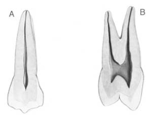 <strong>Figure B below illustrates a view of which surface? </strong> A) Buccal B) Lingual C) Mesial D) Distal