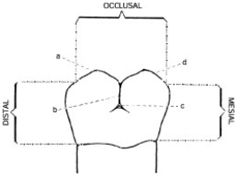 Below is an illustration of the buccal surface of a mandibular right second molar. Structure d depicts the