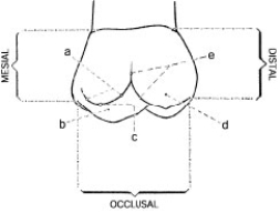 In the figure below, e represents the ____________.  <div style=padding-top: 35px> 