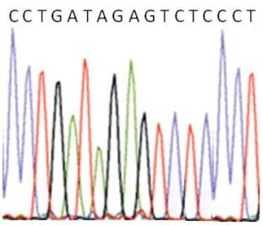 <strong>Shown below is the output from an automated sequencing reaction.What is the sequence of the DNA template strand? </strong> A)5' - CCTGATAGAGTCTCCCT - 3' B)3' - CCTGATAGAGTCTCCCT - 5' C)3' - GGACTATCTCAGAGGGA - 5' D)5' - GGACTATCTCAGAGGGA - 3' E)5' - CCTGATAGAGTCTCCCT - 3'