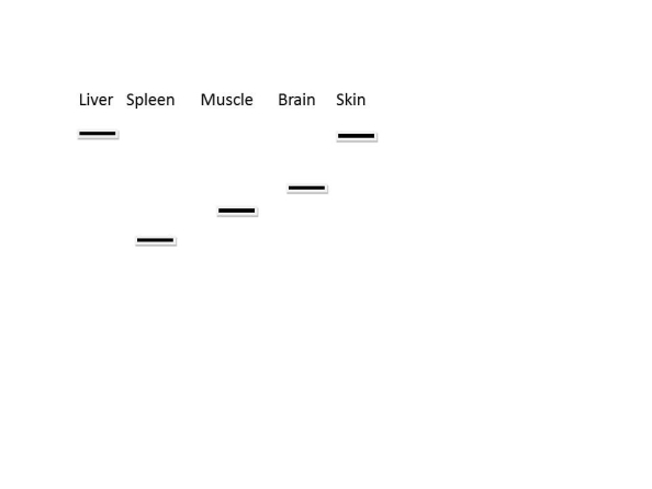 <strong> Northern blot analysis can be used to determine the relative amount and size of different RNA transcripts. Above is a representation of a northern blot analysis of several different tissues for the expression of a single gene. Which of the following statements is correct?</strong> A) Some of the samples contain incompletely processed mRNA B) Some of the samples contain pre-mRNA C) The mRNA is differentially spliced D) All tissues express identical proteins