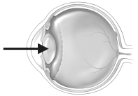 <strong>The figure below depicts a human eye. When focusing on an object that is far away, the structure indicated by the arrow in the figure above</strong> A) becomes flatter. B) becomes more spherical. C) does not change. D) decreases in diameter.
