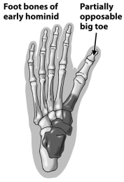 <strong>Examine figure below. What does the positioning of the toe indicated by the arrow suggest about the owner of this fossil hominid foot?</strong> A) This hominid probably spent all of its climbing through trees. B) This hominid was a hybrid produced from the mating of a Neandertal and an archaic human. C) This hominid has a partially opposable toe. It probably walked upright and spent some time in trees. D) This hominid was a member of an extinct line of human evolution that lived exclusively in water. It was probably the source of the myth of the mermaid.