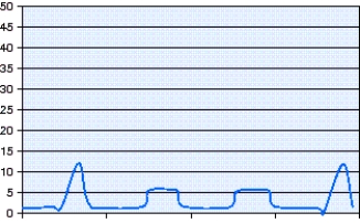 <strong>Which mode of ventilation is shown in the pressure-time scalar in the figure? </strong> A) Pressure-Controlled Synchronized Intermittent Mandatory Ventilation (PC-SIMV)with pressure support (PS) B) Volume-Controlled Synchronized Intermittent Mandatory Ventilation (VC-SIMV)with pressure support (PS) C) Pressure-Controlled Continuous Mandatory Ventilation (PC-CMV) D) Airway Pressure Release Ventilation (APRV)