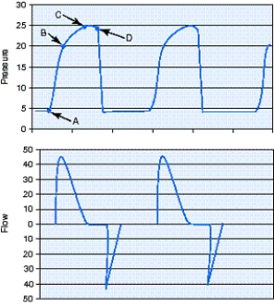<strong>Identify the plateau pressure (P<sub>plateau</sub>)for the pressure-controlled continuous mandatory ventilation (PC-CMV)breaths in the figure. </strong> A) Point A B) Point B C) Point C D) Point D