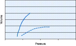 <strong>The static pressure-volume curve shown in the figure indicates the presence of which of the following? </strong> A) Atelectasis B) Pneumonia C) Pneumothorax D) Bronchospasm