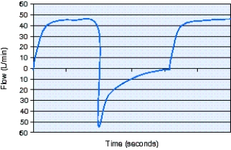 <strong>The peak inspiratory flow rate on the flow-time scalar below is which of the following? </strong> A) 25 L/min B) 40 L/min C) 46 L/min D) 55 L/min