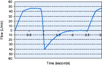 <strong>What is the expiratory time shown in the flow-time scalar below? </strong> A) 1 second B) 1.5 seconds C) 2 seconds D) 2.5 seconds