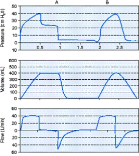 <strong>What is the trigger variable for the A breath shown in the figure below? </strong> A) Flow B) Time C) Pressure D) Volume