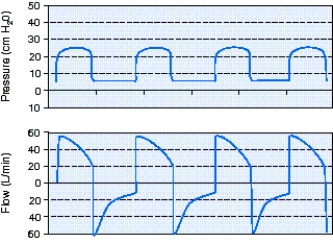 <strong>The ventilator graphics generated by mechanical ventilation with pressure-controlled continuous mandatory ventilation (PC-CMV),rate 18,peak inspiratory pressure (PIP)25 cm H<sub>2</sub>O,positive-end-expiratory pressure (PEEP)5 cm H<sub>2</sub>O,are shown in the scalars below.Interpretation of these scalars reveals which of the following? </strong> A) The flow rate is set too high and should be reduced. B) There is air trapping that could be due to a high respiratory rate. C) The ventilator settings are appropriate and there are no problems. D) There is a leak in the system that needs to be identified and corrected.