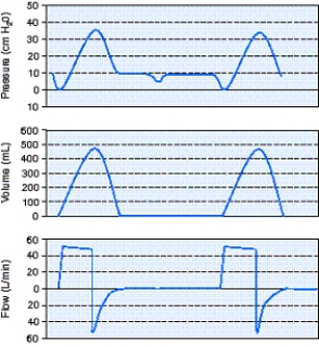 <strong>Identify the improperly set ventilator parameter using the scalars shown below. </strong> A) Mode B) Flow rate C) Sensitivity D) Tidal volume