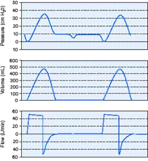 <strong>The respiratory therapist sees the following scalars on the screen of a ventilator providing support to a patient in the ICU.What action should the respiratory therapist take? </strong> A) Switch to the volume-controlled synchronized intermittent mandatory ventilation (VC-SIMV)mode. B) Increase the flow rate to 60 L/min. C) Decrease the sensitivity to 2 cm H<sub>2</sub>O. D) Increase the tidal volume to 550 mL.