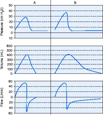 <strong>A patient is receiving full ventilatory support with volume ventilation.At 0700 the respiratory therapist observes the pressure-,volume-,and flow-time scalars shown in A below.Six hours later the respiratory therapist observes the scalars shown in B. The most appropriate action to take is which of the following? </strong> A) Increase the positive-end-expiratory pressure (PEEP)level. B) Check the circuit for a leak. C) Administer a bronchodilator. D) Switch to pressure ventilation.