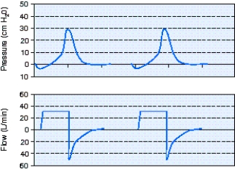 <strong>The respiratory therapist observes the following pressure-time and flow-time scalars following a patient being intubated and placed on a mechanical ventilator using volume ventilation.The most appropriate action is which of the following? </strong> A) Increase the set flow rate. B) Switch to pressure control. C) Increase the set tidal volume. D) Change to a decelerating flow pattern.