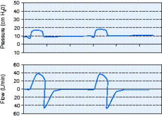 <strong>What is the flow-cycle setting for the pressure support ventilation (PSV)breaths shown in the scalars below? </strong> A) 10% B) 25% C) 40% D) 50%