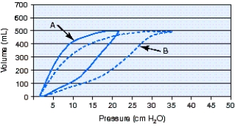 <strong>What is the cause of the change from pressure-volume loop A to pressure-volume loop B during volume-controlled continuous mandatory ventilation (VC-CMV)? </strong> A) Decreased compliance B) Increased compliance C) Decreased airway resistance D) Increased airway resistance