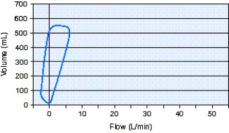 <strong>The type of breath shown in the flow-volume loop below is which of the following? </strong> A) Pressure support ventilation (PSV) B) Continuous positive airway pressure (CPAP) C) Pressure-controlled continuous mandatory ventilation (PC-CMV) D) Spontaneous without support