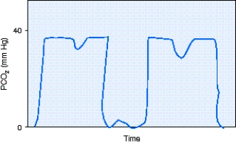 <strong>During shift report,the day shift respiratory therapist informs the night shift respiratory therapist about a freshly postoperative patient who is receiving full support via mechanical ventilation.At the time of the last patient-ventilator system check the patient had not awaken from anesthesia.During first rounds on the day shift the respiratory therapist notes the capnography shown in the figure.The most appropriate action to take would be to do which of the following? </strong> A) Administer a bronchodilator. B) Begin the weaning process. C) Fix the leak in the sampling line. D) Reinflate the ET tube cuff.