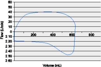 <strong>An intubated patient is receiving mechanical ventilation with the following settings: VC-CMV,rate = 18,V<sub>T</sub> = 850 mL (10 mL/kg),PEEP = 5 cm H<sub>2</sub>O,flow rate = 40 L/min.The patient is sedated and is not assisting the ventilator.During a patient-ventilator system check,the respiratory therapist observes the following ventilator graphic: The respiratory therapist should do which of the following?</strong> A) Decrease the flow rate. B) Increase the PEEP. C) Decrease the rate. D) Increase the V<sub>T</sub>.