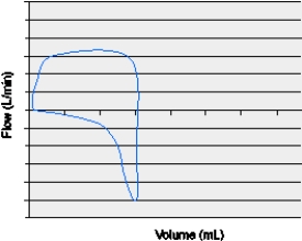 <strong>The respiratory therapist is assessing a mechanically ventilated patient for whom the high pressure alarm is active and the flow-volume loop shows the following: The action that could alleviate this problem is which of the following?</strong> A) Place a bite block into the patient's mouth. B) Perform a recruitment maneuver and increase PEEP. C) Administer a fast-acting bronchodilator and suction the ET tube. D) Insert a 14-gauge needle into the second intercostal space,midclavicular line,right side.
