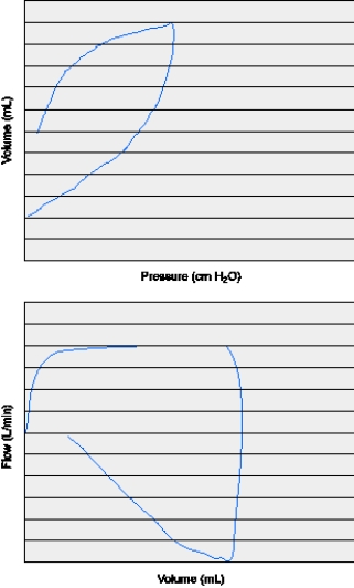 <strong>The following two graphic loops show which of the following conditions? </strong> A) Leak in the patient-ventilator circuit B) Increased airway resistance C) Decreased lung compliance D) Active exhalation