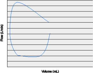 <strong>The flow-volume loop below is representative of which of the following conditions? </strong> A) System leak B) Intrinsic PEEP C) Inadequate flow D) Active exhalation
