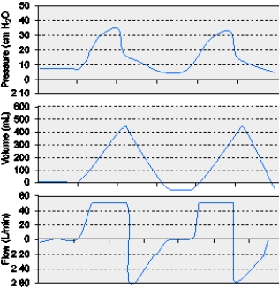 <strong>The graphic below for a patient receiving mechanical ventilation shows which of the following conditions? </strong> A) Leak in the circuit B) Active inspiration C) Active exhalation D) Intrinsic PEEP