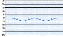 <strong>The graph that shows intrapleural pressure changes during normal spontaneous breathing is depicted by which of the following?</strong> A) B) C) D)