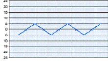 <strong>The graph that shows intrapleural pressure changes during normal spontaneous breathing is depicted by which of the following?</strong> A) B) C) D)