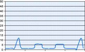 <strong>Which mode of ventilation is shown in the pressure-time scalar in the figure? </strong> A) Pressure-controlled intermittent mandatory ventilation (PC-IMV) with pressure support (PS) B) Volume-controlled intermittent mandatory ventilation (VC-IMV) with pressure support (PS) C) Pressure-controlled continuous mandatory ventilation (PC-CMV) D) Airway pressure release ventilation (APRV)