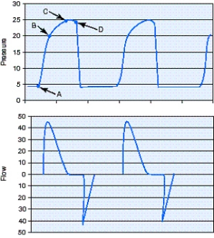 <strong>Identify the plateau pressure (Pₚₗₐₜₑₐᵤ)for the pressure-controlled continuous mandatory ventilation (PC-CMV)breaths in the figure. </strong> A) Point A B) Point B C) Point C D) Point D