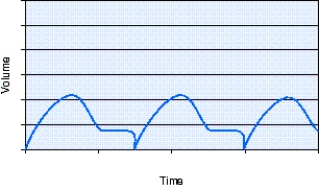 <strong>The volume-time curve is demonstrating which of the following? </strong> A) Auto-PEEP B) System leak C) Plateau pressure D) Volume triggering