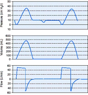 <strong>Identify the improperly set ventilator parameter using the scalars shown below. </strong> A) Mode B) Flow rate C) Sensitivity D) Tidal volume