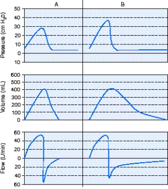 <strong>A patient is receiving full ventilatory support with volume ventilation.At 0700 the respiratory therapist observes the pressure-,volume-,and flow-time scalars shown in A below.Six hours later the respiratory therapist observes the scalars shown in B. The most appropriate action to take is which of the following? </strong> A) Increase the positive end-expiratory pressure (PEEP) level. B) Check the circuit for a leak. C) Administer a bronchodilator. D) Switch to pressure ventilation.