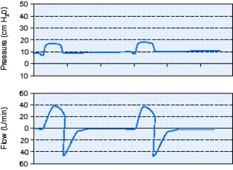 <strong>What is the flow-cycle setting for the pressure support ventilation (PSV)breaths shown in the scalars below? </strong> A) 10% B) 25% C) 40% D) 50%