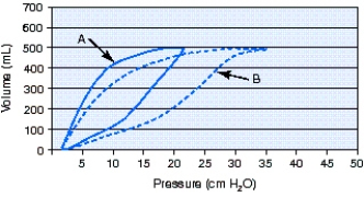 <strong>What is the cause of the change from pressure-volume loop A to pressure-volume loop B during volume-controlled continuous mandatory ventilation (VC-CMV)? </strong> A) Decreased compliance B) Increased compliance C) Decreased airway resistance D) Increased airway resistance