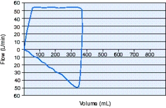 <strong>Identify the type of flow waveform the ventilator is delivering from the flow-volume loop below. </strong> A) Ascending ramp B) Rectangular C) Descending ramp D) Exponential decay