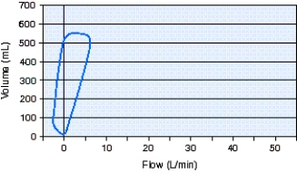 <strong>The type of breath shown in the flow-volume loop below is which of the following? </strong> A) Pressure support ventilation (PSV) B) Continuous positive airway pressure (CPAP) C) Pressure-controlled continuous mandatory ventilation (PC-CMV) D) Spontaneous without support