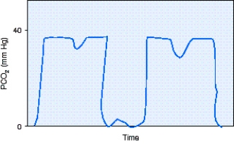 <strong>During shift report,the day shift respiratory therapist informs the night shift respiratory therapist about a freshly postoperative patient who is receiving full support via mechanical ventilation.At the time of the last patient-ventilator system check the patient had not awaken from anesthesia.During first round on the day shift the respiratory therapist notes the capnography shown in the figure.The most appropriate action to take would be to do which of the following? </strong> A) Administer a bronchodilator. B) Begin the weaning process. C) Fix the leak in the sampling line. D) Reinflate the ET tube cuff.
